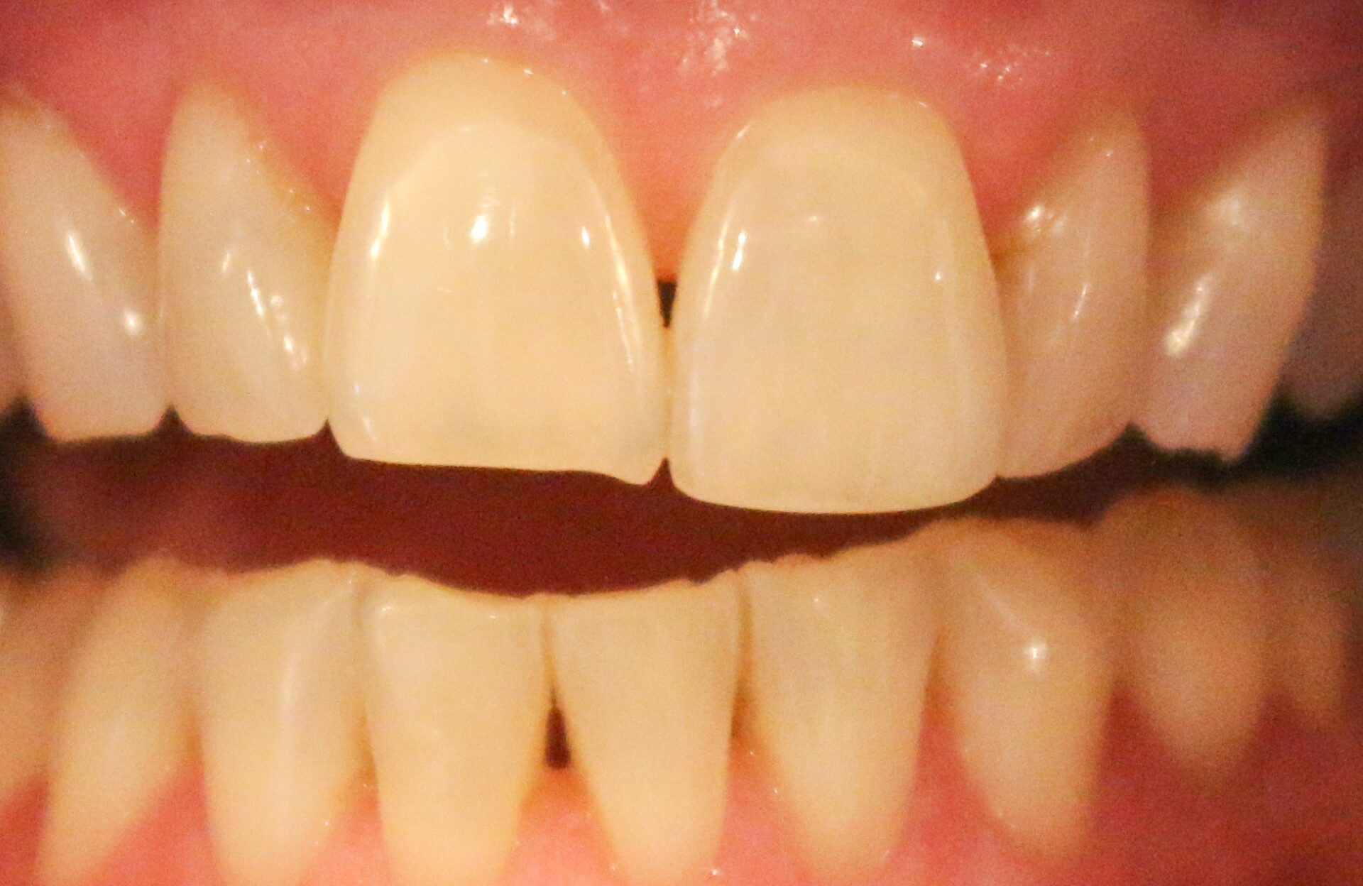 1 1
