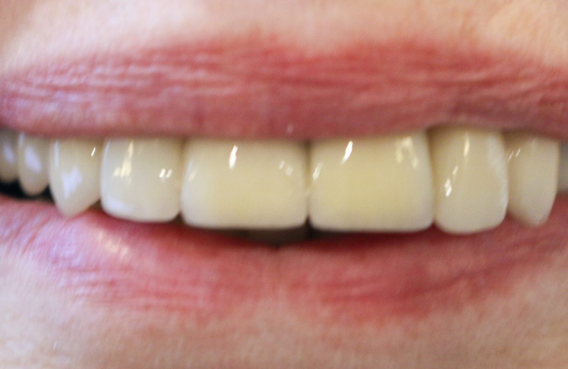 1 1